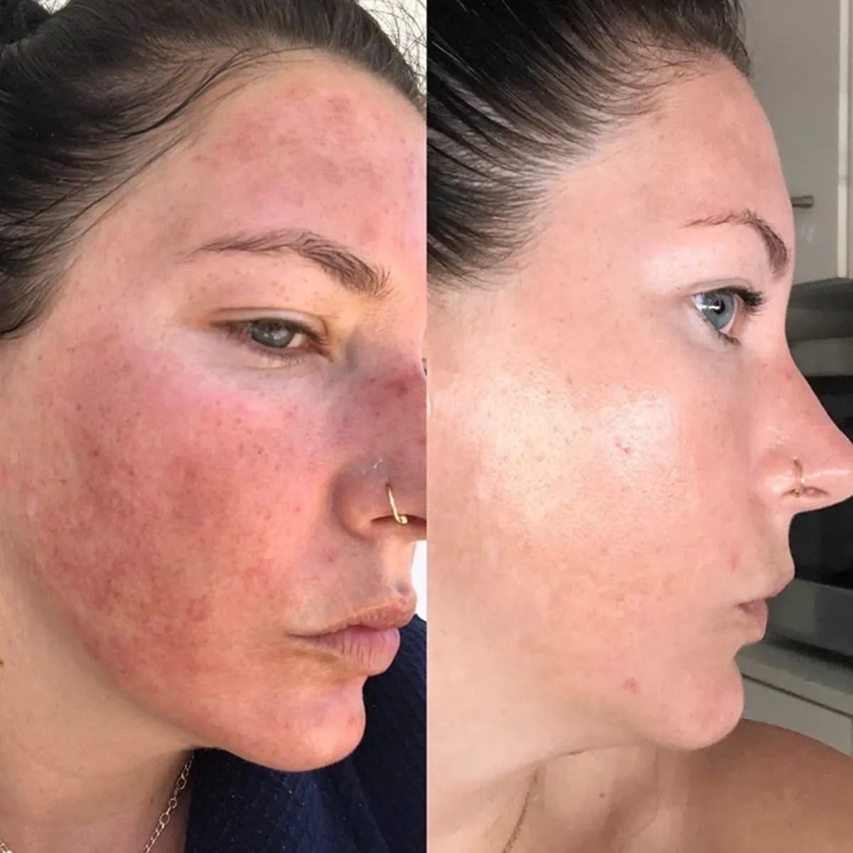 Firm And Glow Bundle