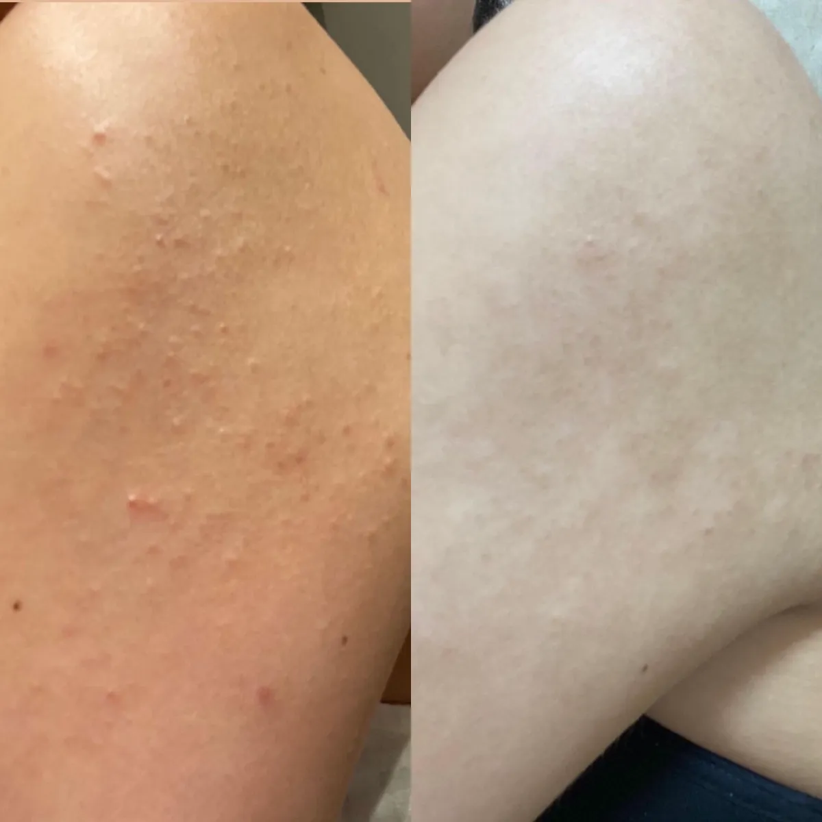 Firm And Glow Bundle
